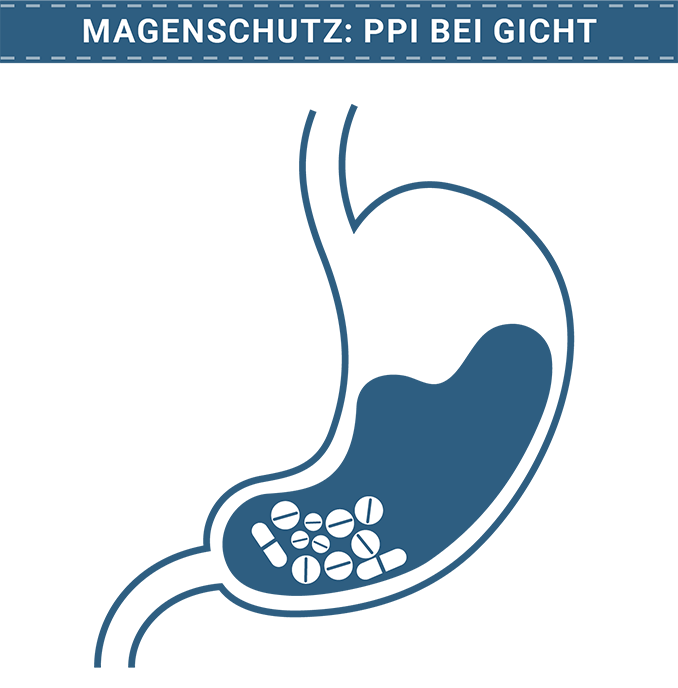 Ein Magenschutz mit PPI ist eine wichtige Ergänzung, wenn Medikamente wie Schmerztabletten und Cortison zusammen gegen den Gichtanfall eingenommen werden